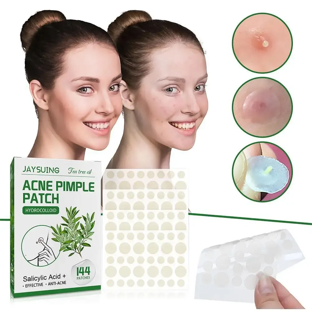 144pcs Hydrocolloid Salicylic Acid Acne Pimple Patches Treatment For Zits Blemishes Tea Tree Oil Control Redness Repair 144pcs Hydrocolloid Salicylic Acid Acne Pimple Patches Treatment For Zits Blemishes Tea Tree Oil Control Redness Repair