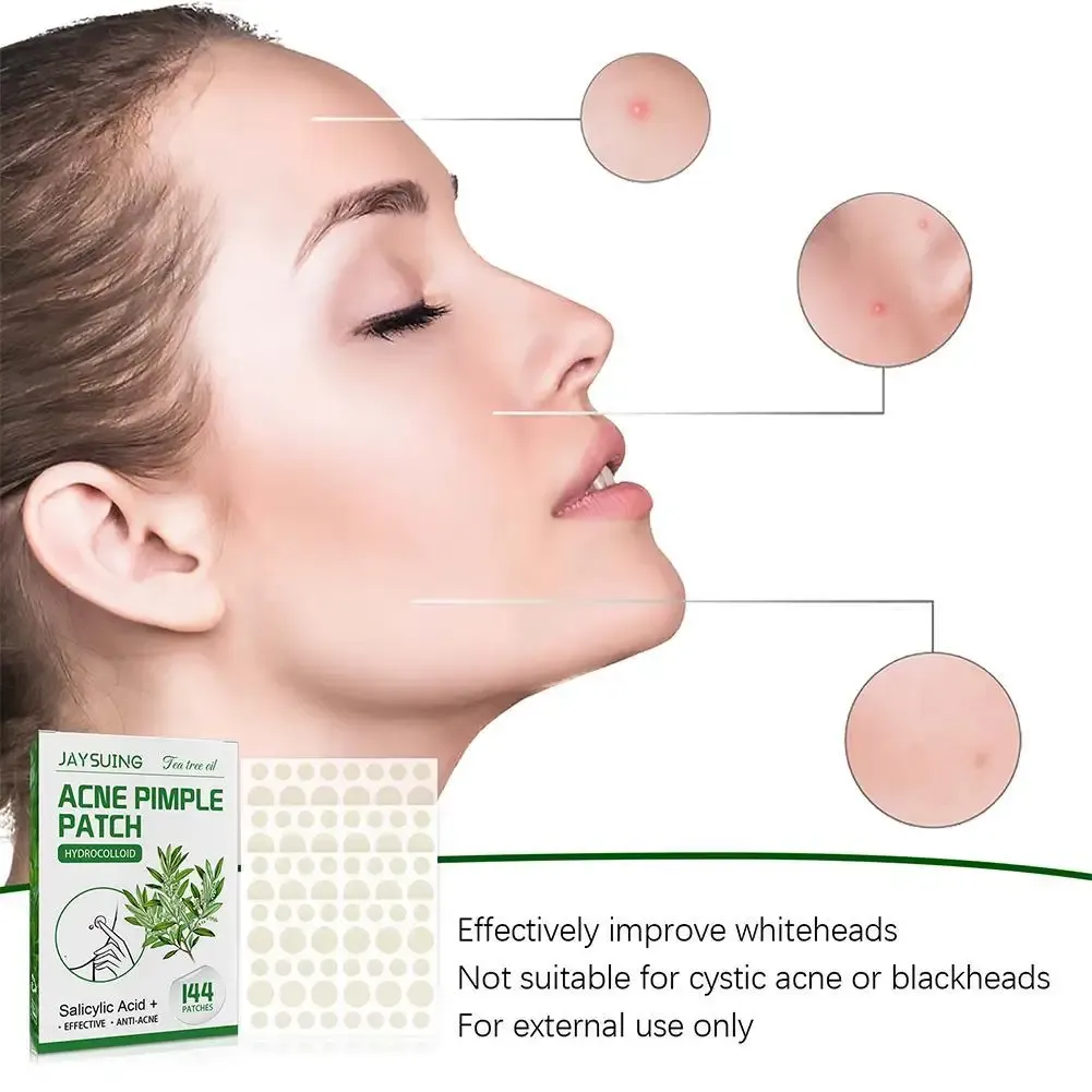 144pcs Hydrocolloid Salicylic Acid Acne Pimple Patches Treatment For Zits Blemishes Tea Tree Oil Control Redness Repair 144pcs Hydrocolloid Salicylic Acid Acne Pimple Patches Treatment For Zits Blemishes Tea Tree Oil Control Redness Repair