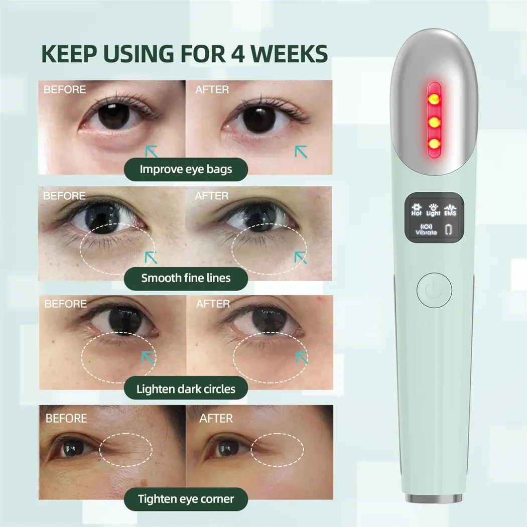 EMS Eye Massager Red Light Therapy Vibration Lip and Eye Massage Tool with Hot Compress Reduce Wrinkles Anti Dark Circles EMS Eye Massager Red Light Therapy Vibration Lip and Eye Massage Tool with Hot Compress Reduce Wrinkles Anti Dark Circles