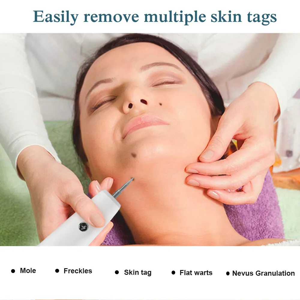 ⁦מכשיר מקצועי להסרת שומות נמשים וקעקועים⁩ – תמונה ⁦10⁩