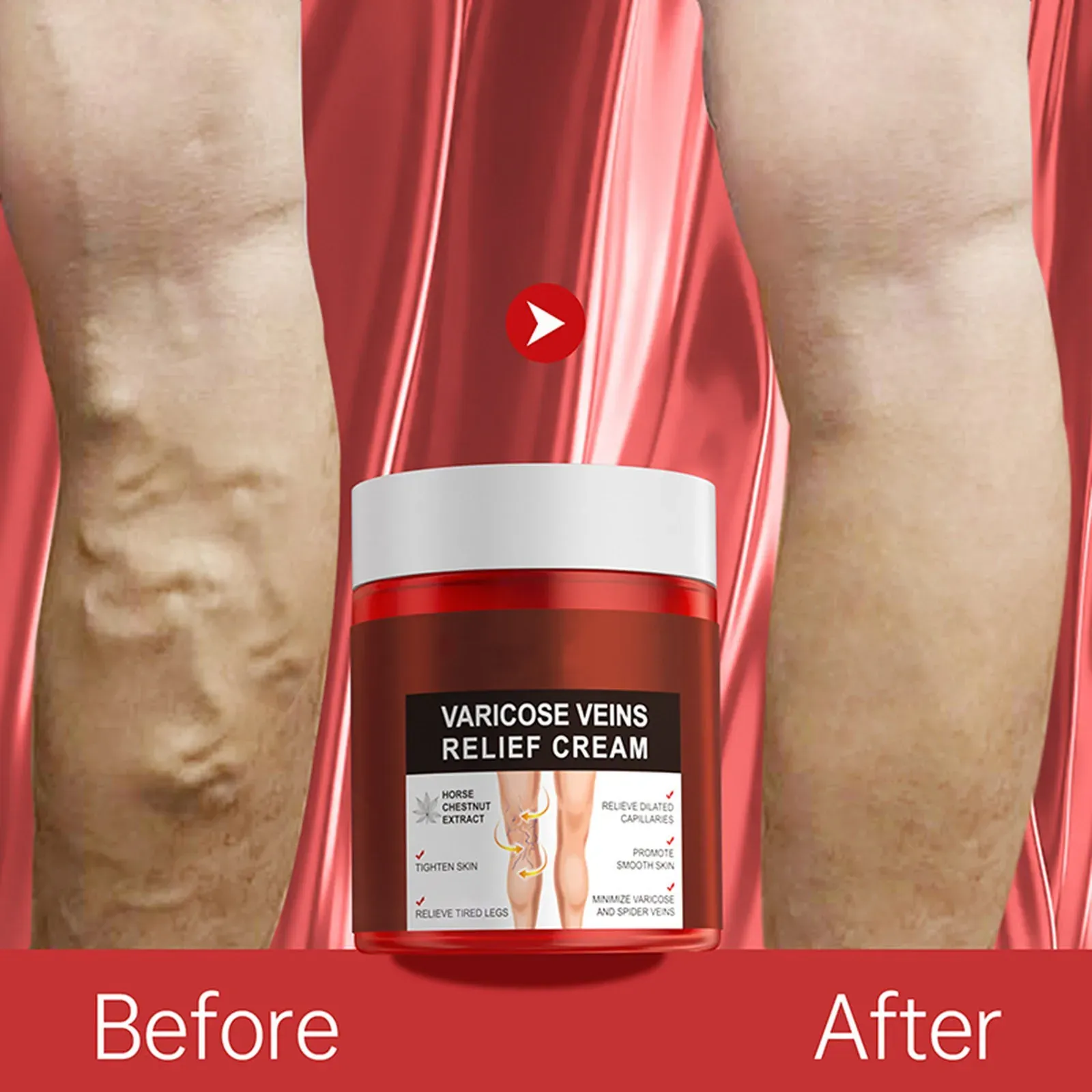 Varicose Vein Relief Paste Improve Blood Circulations Spider Varicose Vein For Tired Heavy Legs Fast Relief New Varicose Vein Relief Paste Improve Blood Circulations Spider Varicose Vein For Tired Heavy Legs Fast Relief New