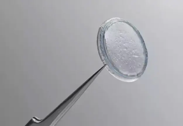 Home 12 Tweezers holding a clear, round contact lens with many small trapped bubbles.