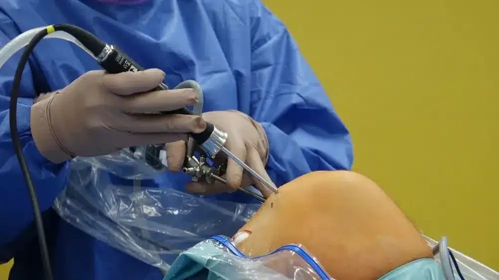Minimally Invasive Spine Surgery in Plano, TX | Same-Week Consults 3 Small minimally invasive surgical instruments used for spine decompression procedures