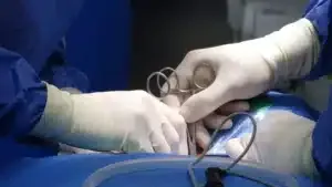 Surgeon performing minimally invasive spine surgery for spinal stenosis in Plano TX