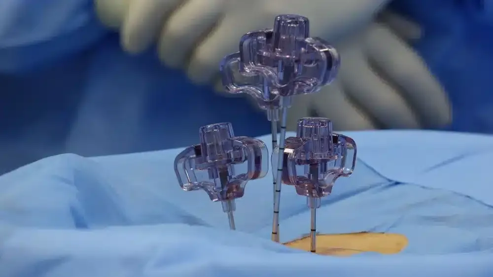 Intrathecal Pain Pump in Longview, TX | Same-Week Consults 2 Fluoroscopy imaging used during a minimally invasive intrathecal catheter placement procedure