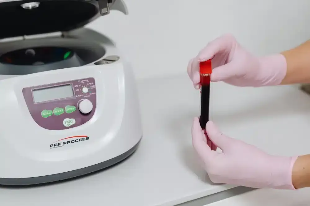 PRP Injection for Tendon Injuries in Tyler, TX | Non-Surgical Care 2 Medical technician processing blood sample in centrifuge for PRP preparation
