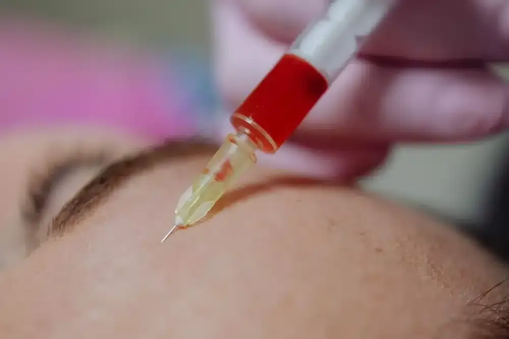 Trigger Point Injections in Plano, TX | Same-Week Consults 2 Healthcare provider administering a trigger point injection into a patient's upper back muscle