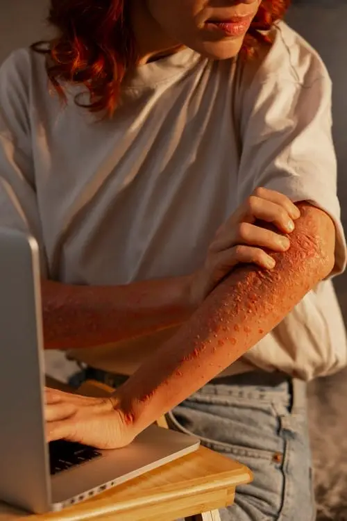 woman experiencing skin disease