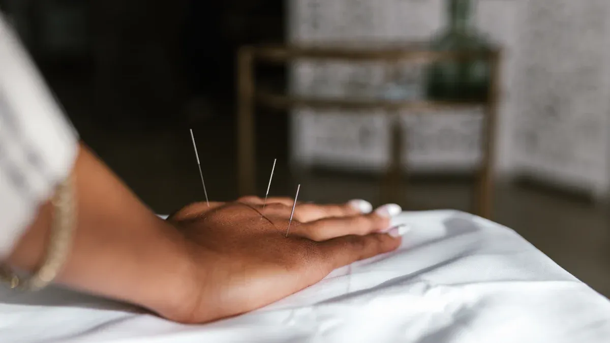 What to Expect: Consultation Process for Acupuncture, Dry Needling & Cosmetic Acupuncture