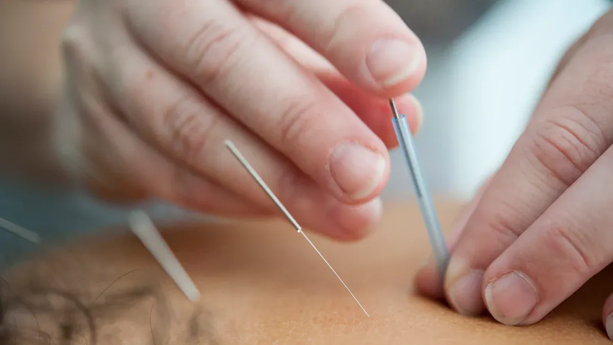 Medical Acupuncture Consultation