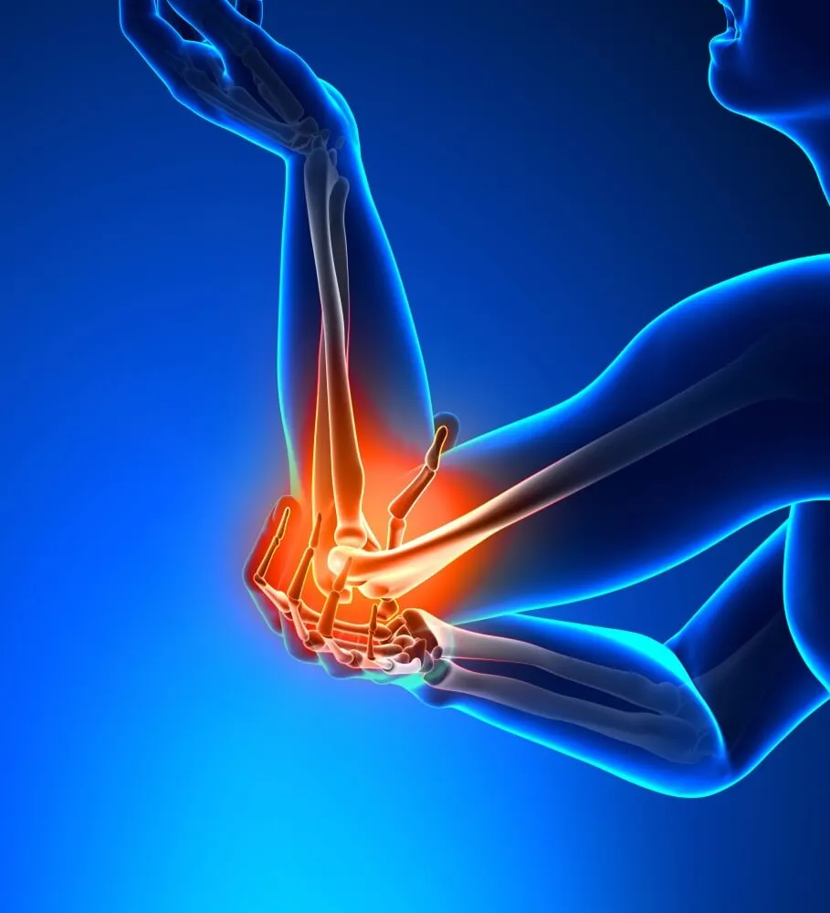 Fysiotherapie elleboog