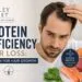 Protein Deficiency Hair Loss: Protein for Hair Growth Protein Deficiency Hair Loss