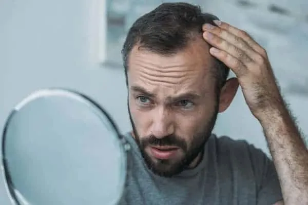 Does Creatine Cause Hair Loss? does creatine cause hair loss