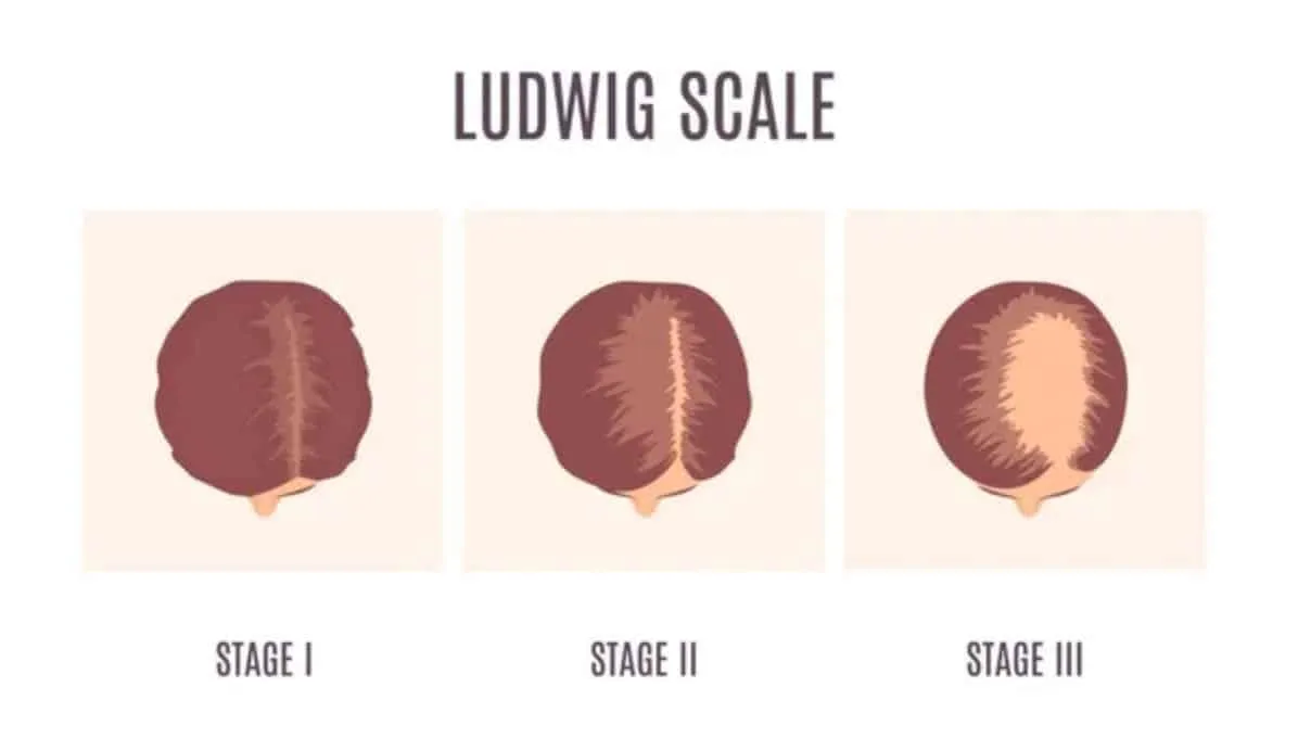 The Ludwig Scale ludwig scale 1 2 3