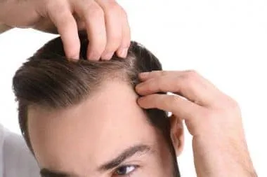 Widow's Peak : What Does it Mean? man with widow's peak hairline