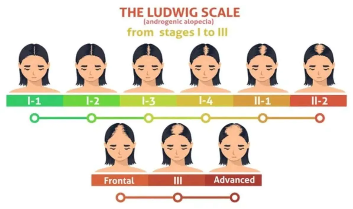 The Ludwig Scale the ludwig scale stages
