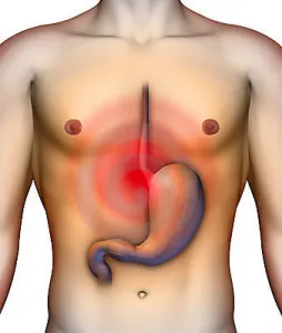 proton pump inhibitors acid reflux