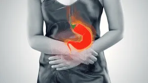 acid reflux
