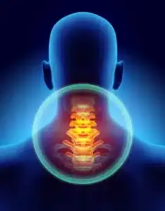 Neck Pain treatment in Houston