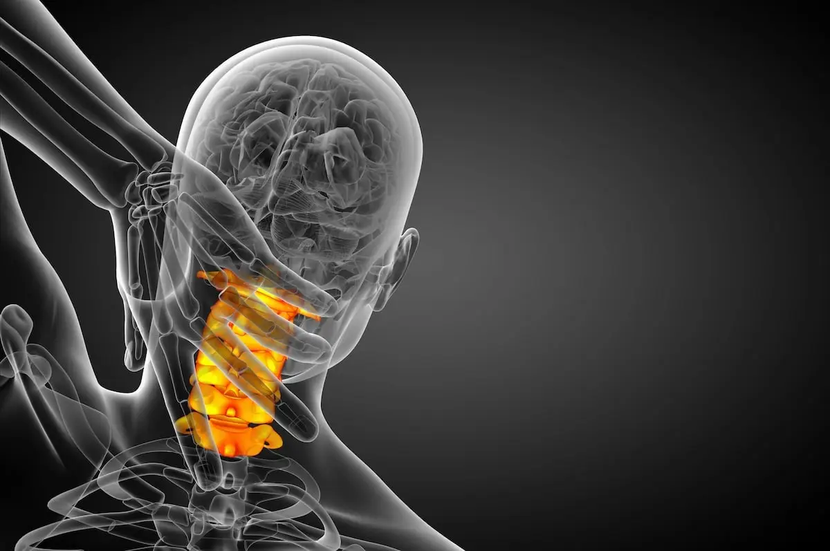 Cervical lordosis it is a common problem in our technology age due to heavy smartphone and computer use.