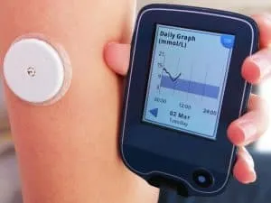 Moment of reading a glucose levels using device for continuous glucose monitoring in blood CGM. On arm is placed white sensor witch send information to the CGM device.
