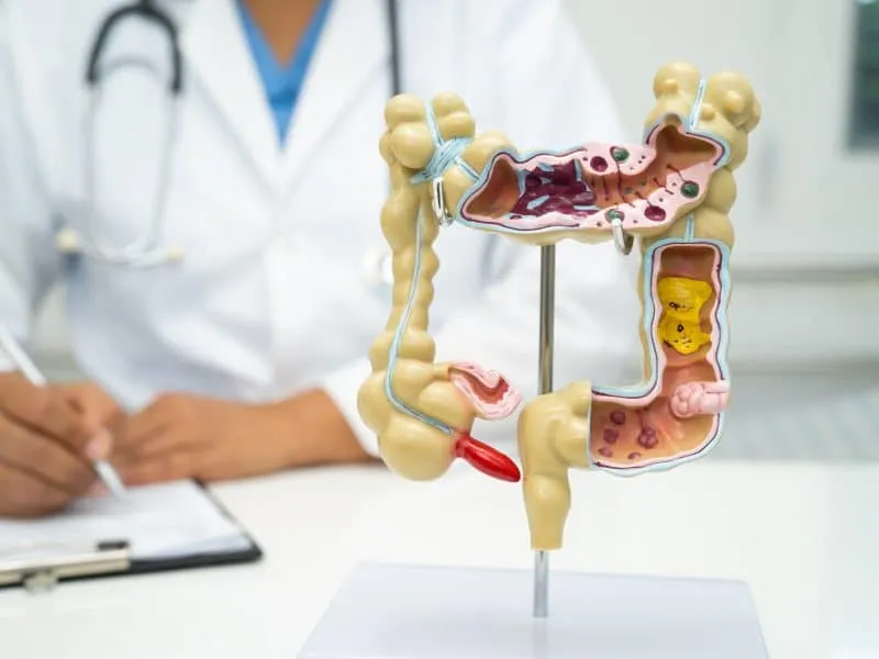 Intestine, appendix and digestive system, doctor holding anatomy model for study diagnosis and treatment in hospital.