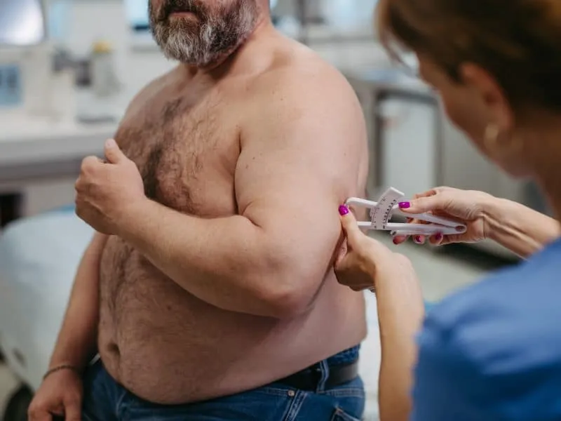 Female doctor measuring the body fat of overweight patient using a caliper. Obesity affecting middle-aged men's health. Concept of health risks of overwight and obesity.