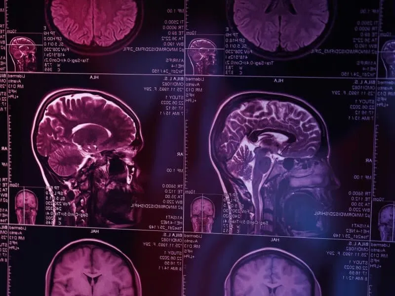 mri imaging of a head