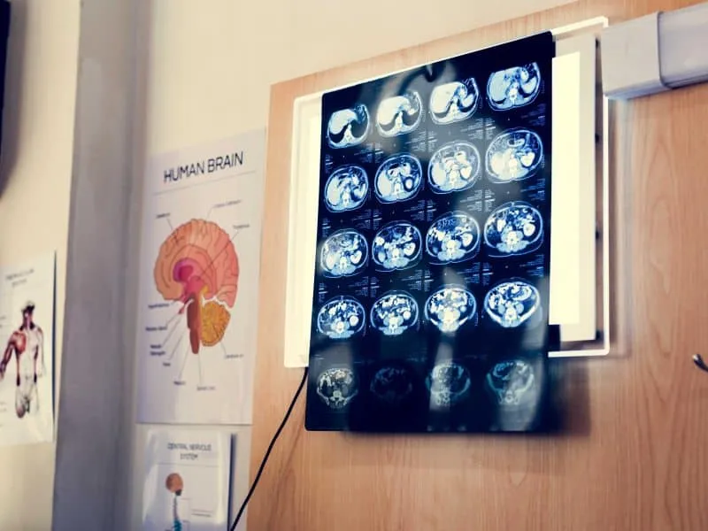 x-ray results on wall