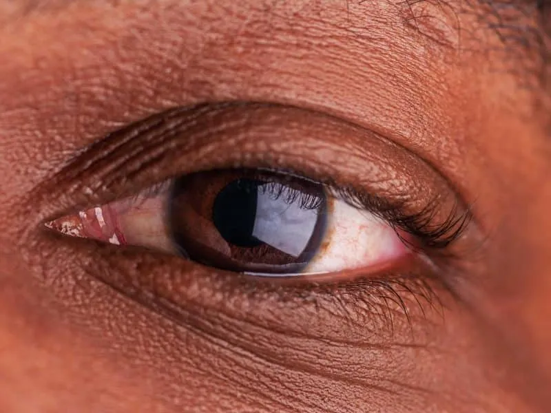 close up photo of a mans eye
