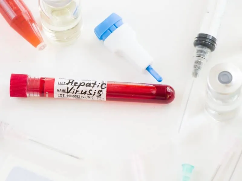 A closeup shot of a Hepatitis C blood test sample on a diagnostic lab table