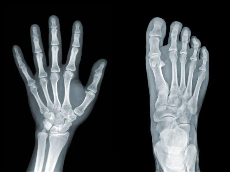 X-ray of hand and foot on black background