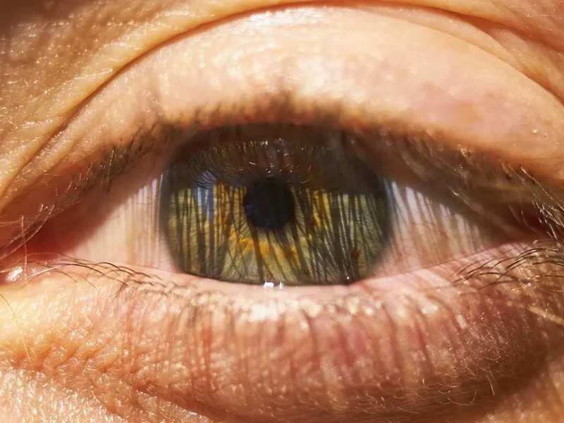 close up picture of an eye