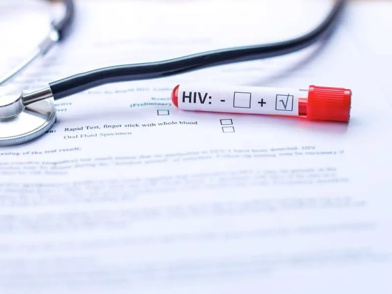 stethoscope-and-hiv-test-tube-with-blood-2025-03-16-17-16-59-utc